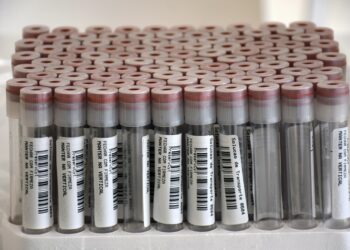 Apenas quatro infetados entre os idosos e funcionários dos lares de Famalicão