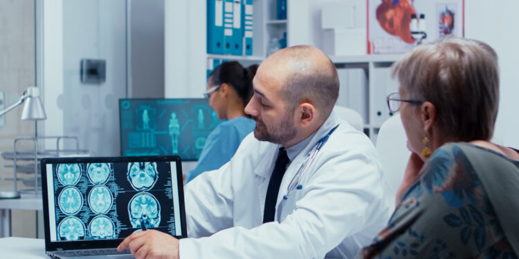 Alzheimer:  Novo medicamento