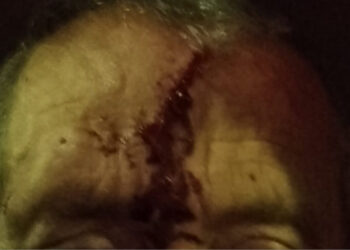 Taxista agredido em Famalicão